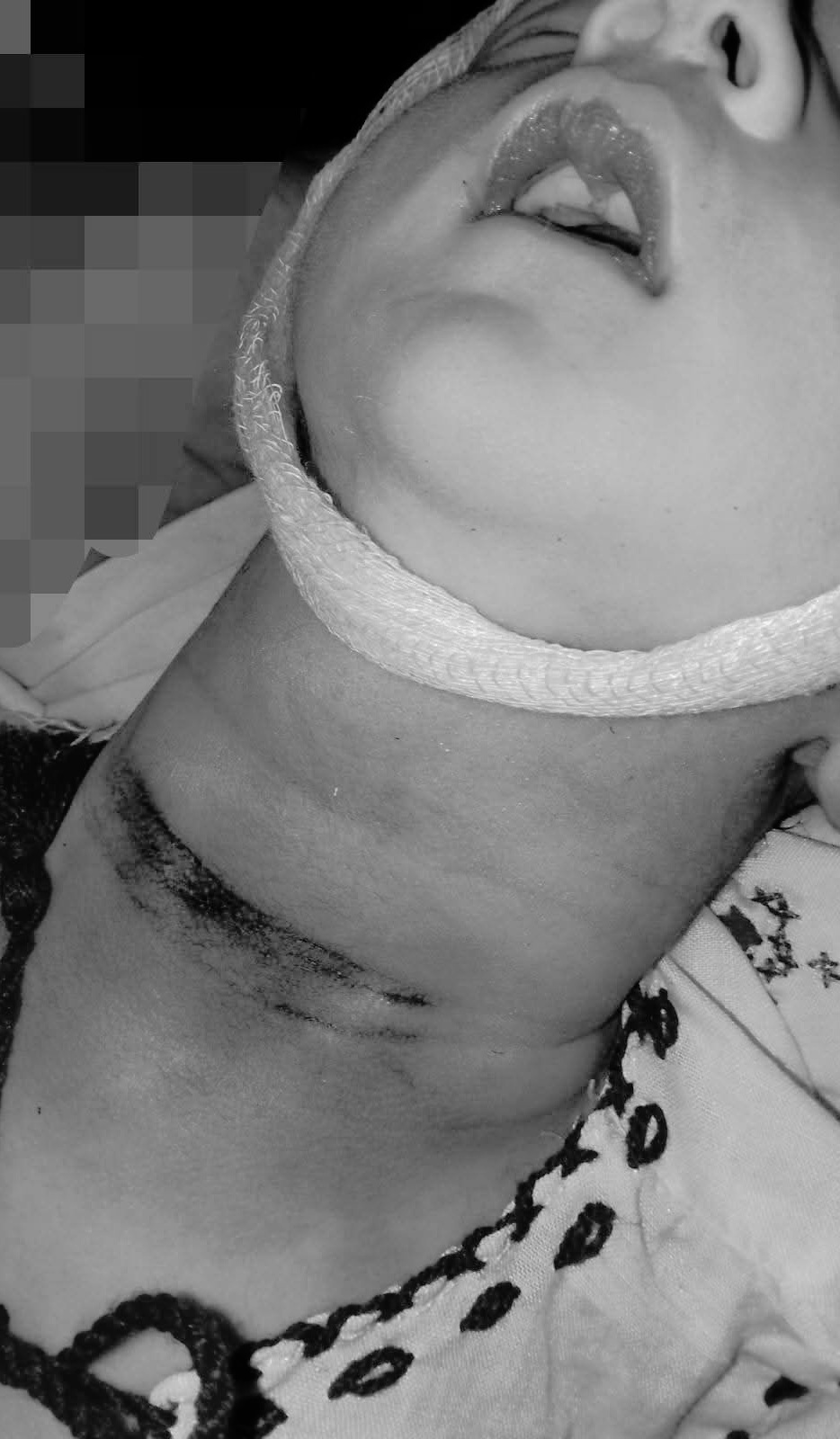 حمیرا کلینک میں مردہ بچی کی پیدائش، گلے اور جسم پر زخموں کے نشانات، مبینہ غفلت کی تحقیقات کا مطالبہ